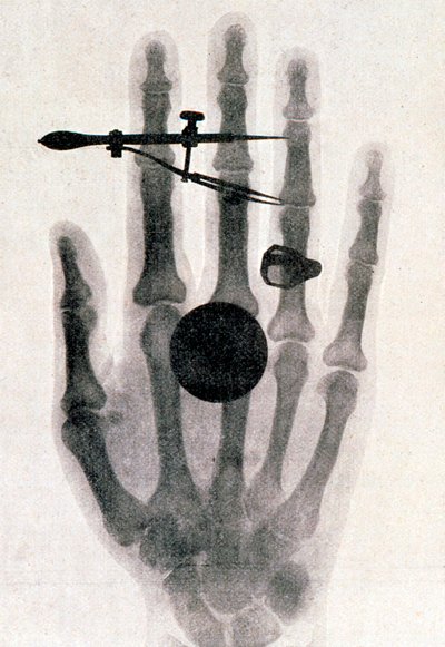 Wilhelm Roentgen