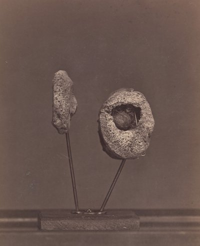 Uitgesneden kniegewricht. Een ronde musketbal in de binnenste condyl van het rechterdijbeen [Gardin..., 1866-67 door William H. Bell