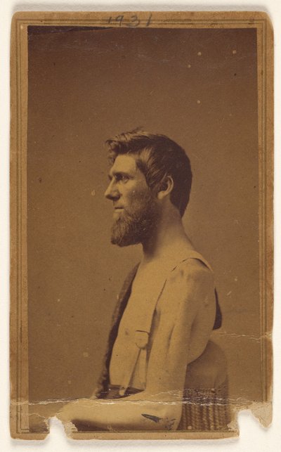 [Ongeïdentificeerd burgeroorlog slachtoffer in profiel, zittend]. door William H. Bell