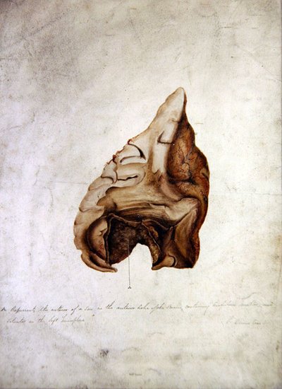 Studie van de Hersenen I, c.1850 door William Lover