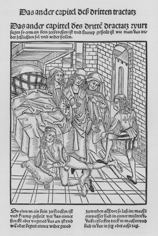 Het boek van Cirurgia door Hieronymus Brunschwig door (after) German School