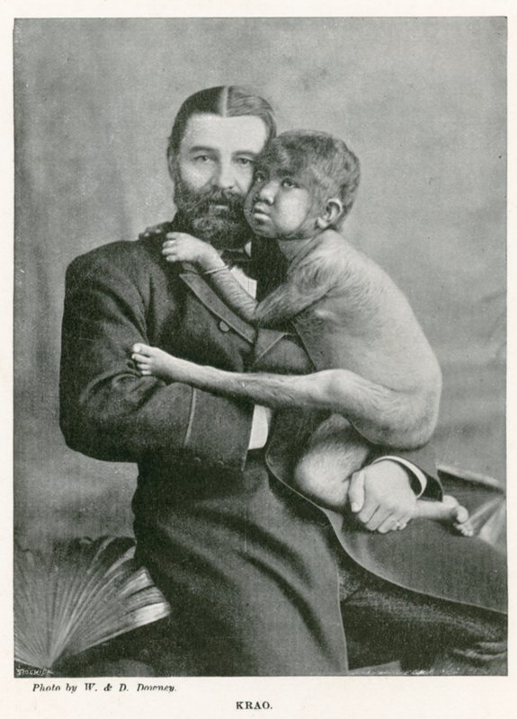 Krao, De Missing Link, tentoongesteld in het Aquarium, Westminster, Londen, in 1887 door English Photographer