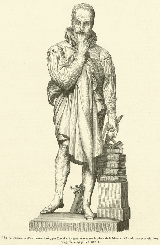Bronzen standbeeld van Ambroise Pare door French School