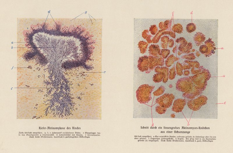 Actinomyces bovis door German School
