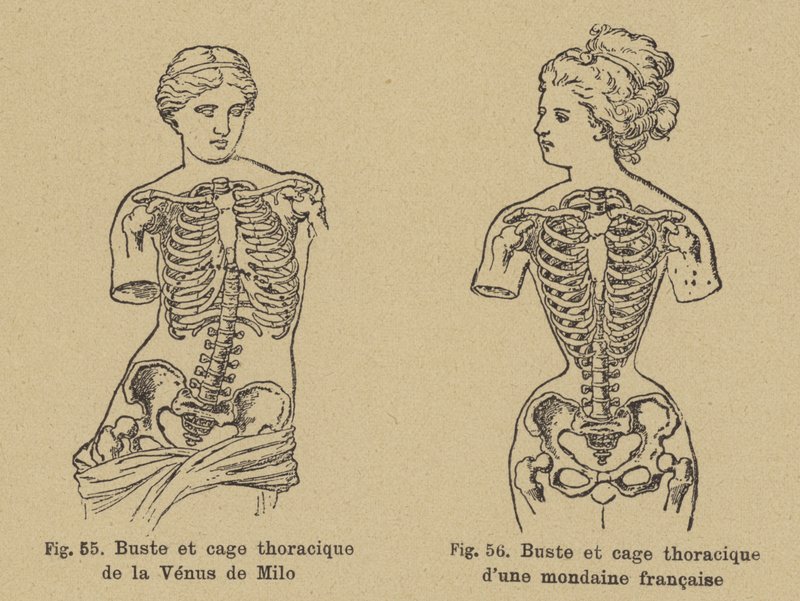 Vergelijking van de vorm van de borst en ribbenkast van de Venus van Milo met die van een Franse socialite uit de late 19e eeuw door German School