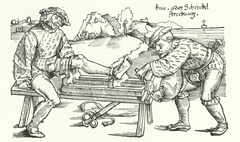 Apparaat voor het rechtzetten van een gewonde been (gravure) door German School