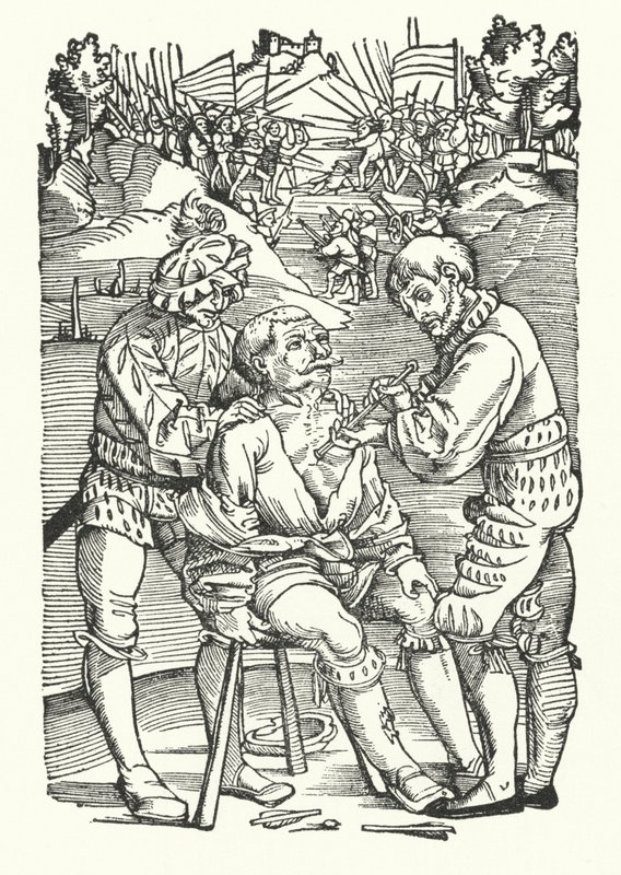 Behandeling van een gewonde soldaat op het slagveld (gravure) door German School