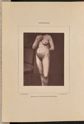 Gegeneraliseerde vesiculaire syfilis