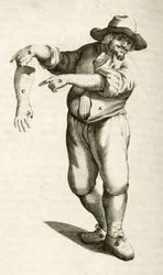 Verwijderen van dode huid met puisten, uit Exercitationes Practicae circa Medendi Methodum door Frederik Dekkers, 1694
