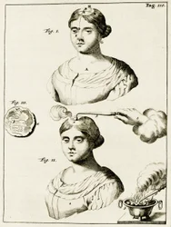 Behandeling van een epilepsiepatiënt, uit Exercitationes Practicae circa Medendi Methodum door Frederik Dekkers, 1694
