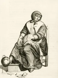 Gebruik van een mechanische bloedzuiger, uit Exercitationes Practicae circa Medendi Methodum door Frederik Dekkers, 1694