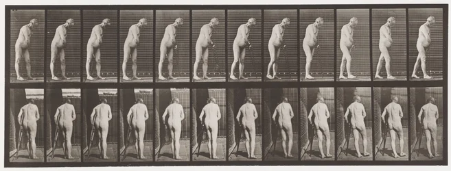 Hemiplegie; Lopen met Kruk, 1885