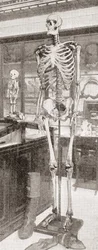De skeletten van Charles Byrne