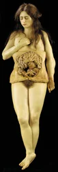 Anatomisch model van een ovariumzwangerschap