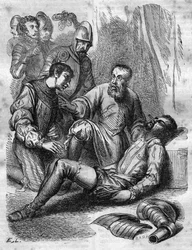 Ambroise Pare, Franse chirurg