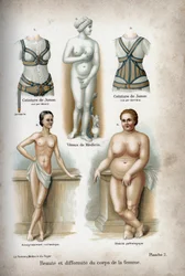 Verfraaiing en misvorming van het vrouwenlichaam: een te magere vrouw en een zwaarlijvige vrouw die onder de Venus van Medicis staan, beschouwd als de "ideale vrouw".