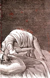 Hysterie, mentale en zenuwstoornis, voortkomend uit intense angst. 1887