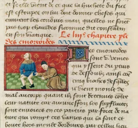 Onderzoek van een patiënt met aambeien, uit Le Livre des Proprietes des choses door Barthelemy l