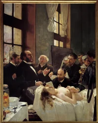 Dr. Jules-Émile Péan (1830-1898) onderwijst in het Hôpital Saint-Louis zijn ontdekking van het afklemmen van bloedvaten. „Voor de operatie”. Schilderij van Henri Gervex (1852-1929), 1887. H. 2,42 x 1,88 m, Parijs, Musée d