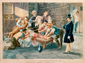 Patriot en lid van de Carboneria Pietro Maroncelli (1795-1846) kreeg tijdens zijn gevangenschap in de gevangenis van de vesting Spielberg in Moravië zijn been geamputeerd. Prenten uit de 19e eeuw, Museo del Risorgimento, Milaan