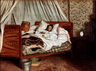 De geïmproviseerde ambulance (Claude Monet gewond). Schilderij van Jean Frédéric Bazille (1841-1870)