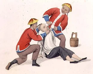 Het verbranden van de ogen van een man met kalk, plaat 11 uit 