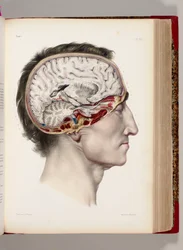 Een met de hand gekleurde lithografie van een ontleed hoofd in profiel die de hersenen toont, uit 