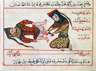 Geneeskunde: operatie van een hermafrodiet. Miniatuur uit een verhandeling over Turkse geneeskunde van Sharaf al-din