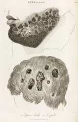 Dermatologie Huidziekten