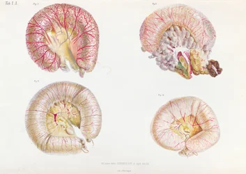Het externe oppervlak van de darmen geïnfecteerd met cholera, uit Anatomie Pathologique du Cholera Morbus, door Nikolai Ivanovich Pirogov, gepubliceerd in St. Petersburg, 1849