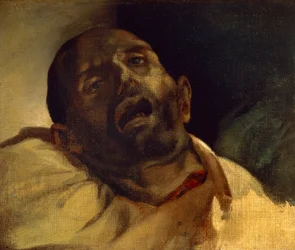 Hoofd van een geguillotineerde man (Le guillotine), door Jean-Louis Theodore Gericault (1791-1824)