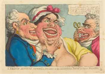 Een Franse Tandarts die een Voorbeeld van zijn Kunstgebitten en Valse Gehemeltes Toont