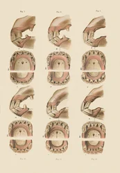 Beschrijving van plaat die de leeftijd aangeeft, zoals aangegeven door de tanden, c1879