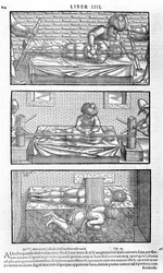 Illustratie uit Liber canonis de medicinis cordialibus door Avicenna, 1556