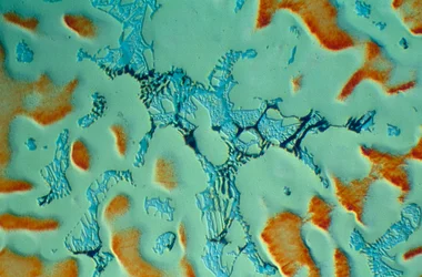 Kanonnenmetaal