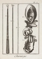 Uitrusting, vroegmoderne chirurgische instrumenten en diagrammen van lichaamsdelen