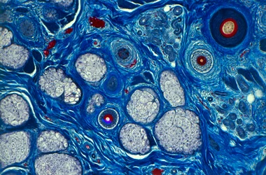 Menselijke huid, gezien onder een microscoop, toont haarschacht en zweetporiën