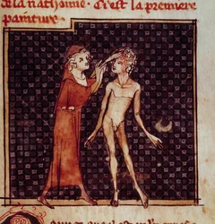 Anatomische figuur: De chirurg snijdt het voorhoofd van een patiënt in. Miniatuur uit het manuscript 