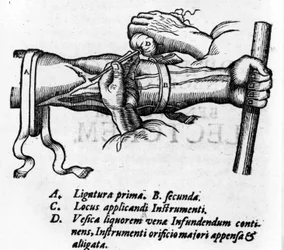 Anatomische plaat: verschillende ligaturen. Werk over het bloedsysteem door William Harvey (1578-1657), Engelse arts. Hij beschreef de bloedsomloop in het lichaam via de aderen