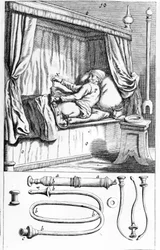 Clystère (voor klysma