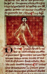 Anatomische figuur: huid, borst open. Miniatuur uit het manuscript Chirurgie geschreven door Henri de Mondeville