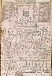 Autopsie. Codex. Het lichaam van een dode man ontleed door artsen voor een anatomische studie. 