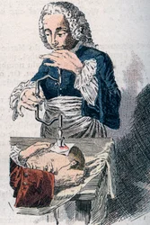 De trepanatie. Prent uit de 18e eeuw.