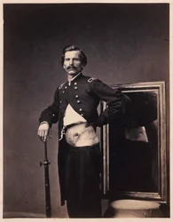 Majoor H.A. Barnum, Herstel na een doordringende schotwond in de buik met perforatie van de linker keelholte, uit de fotocatalogus van de afdeling Chirurgie